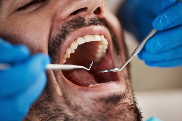 Best Emergency Treatment for Toothache in Sharon, MS